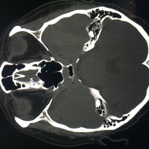 Targeted Individual Evidence